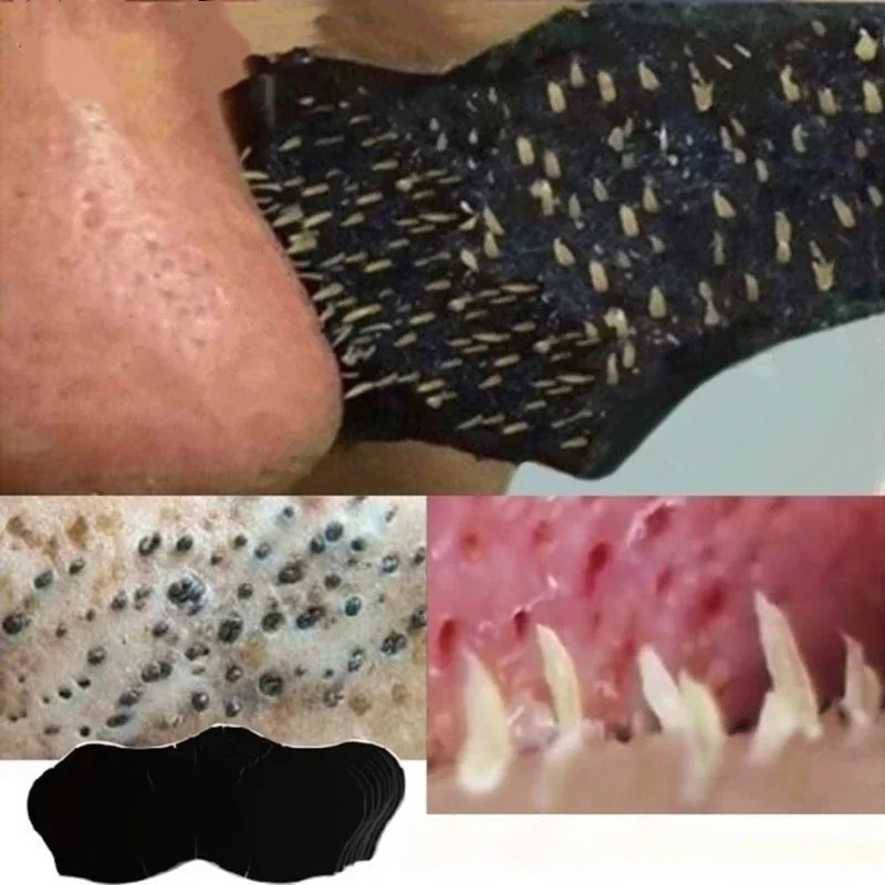 Unisex Blackhead Remove Mask N - Charcoal Pore Strip 评论和价格