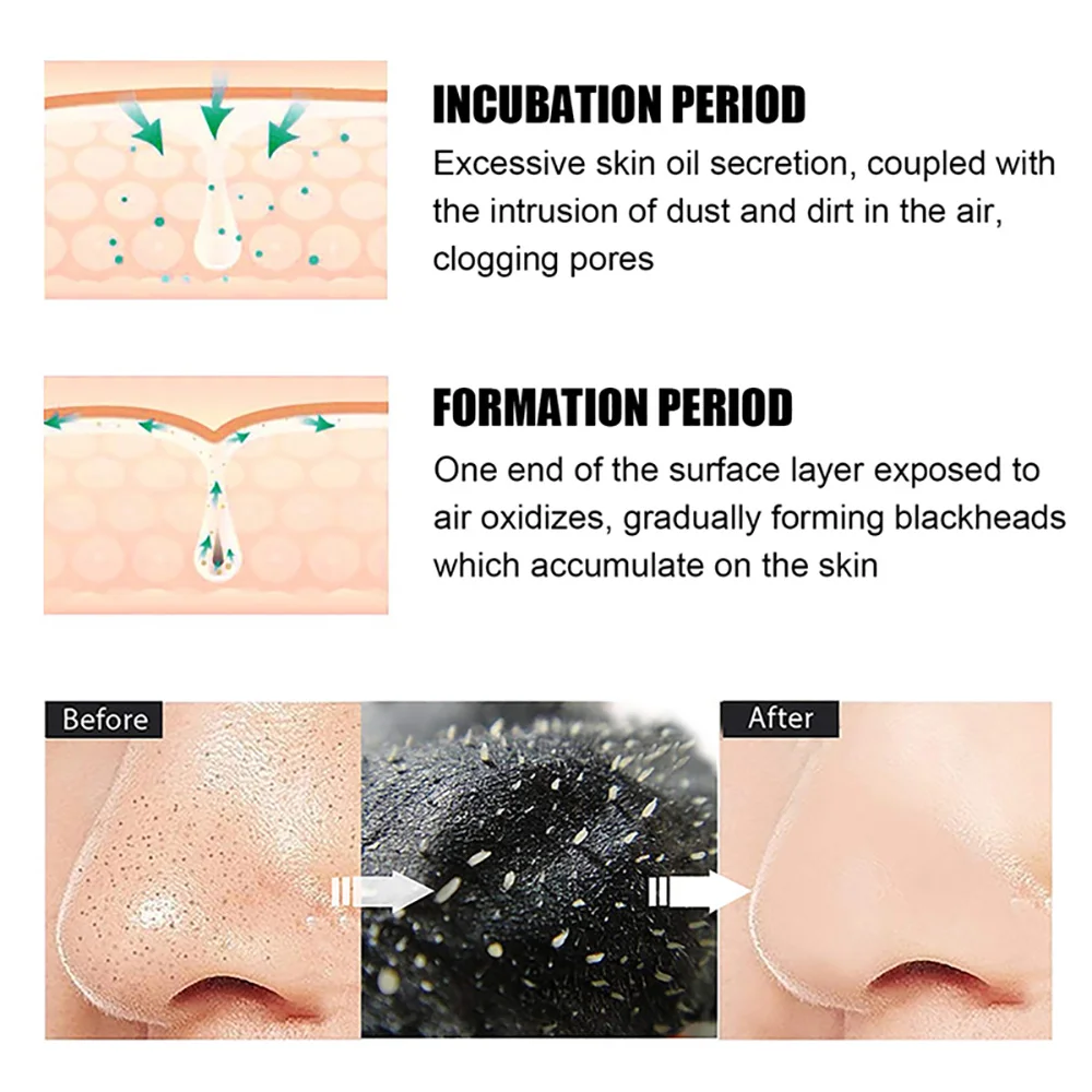 10/20/50/100PCS Blackhead Remo - Charcoal Pore Strip 评论和价格